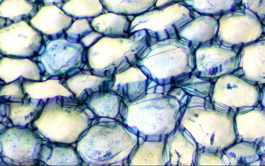 Au microscope optique et un peu de teinture, on voit très bien la structure cellulaire de la plante.