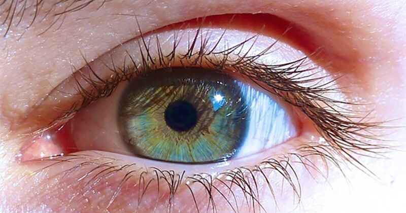 Cannabis et yeux