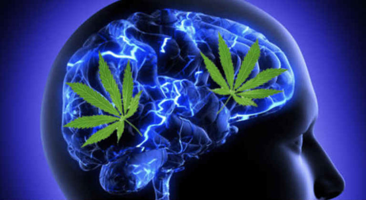 cerveau