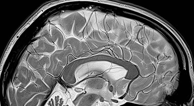 CBD et THC sur le cerveau