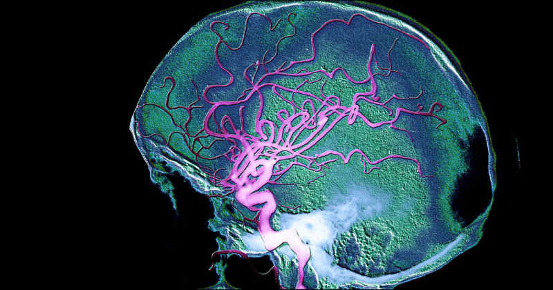 barrière hémato encéphalique cerveau CBD