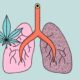 Etude sur l'effet du cannabis et du tabac sur le poumon