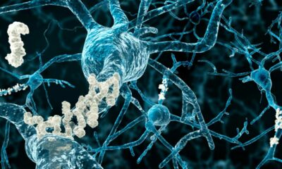 CBD pour la mémoire et contre Alzheimer