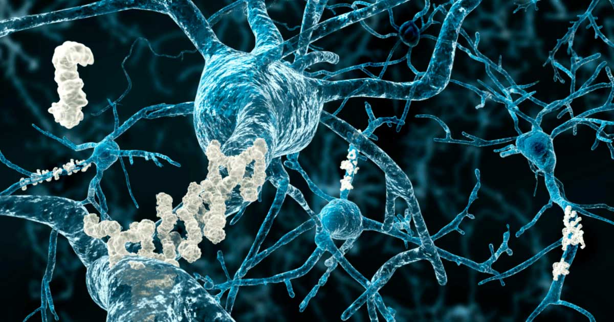 CBD pour la mémoire et contre Alzheimer