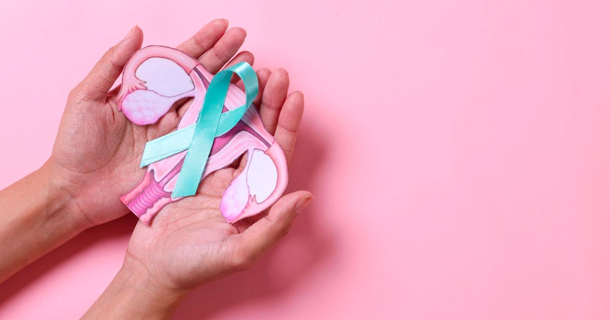 CBD et THC sur le cancer de l'ovaire