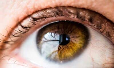 CBD and the Treatment of Ocular Inflammation